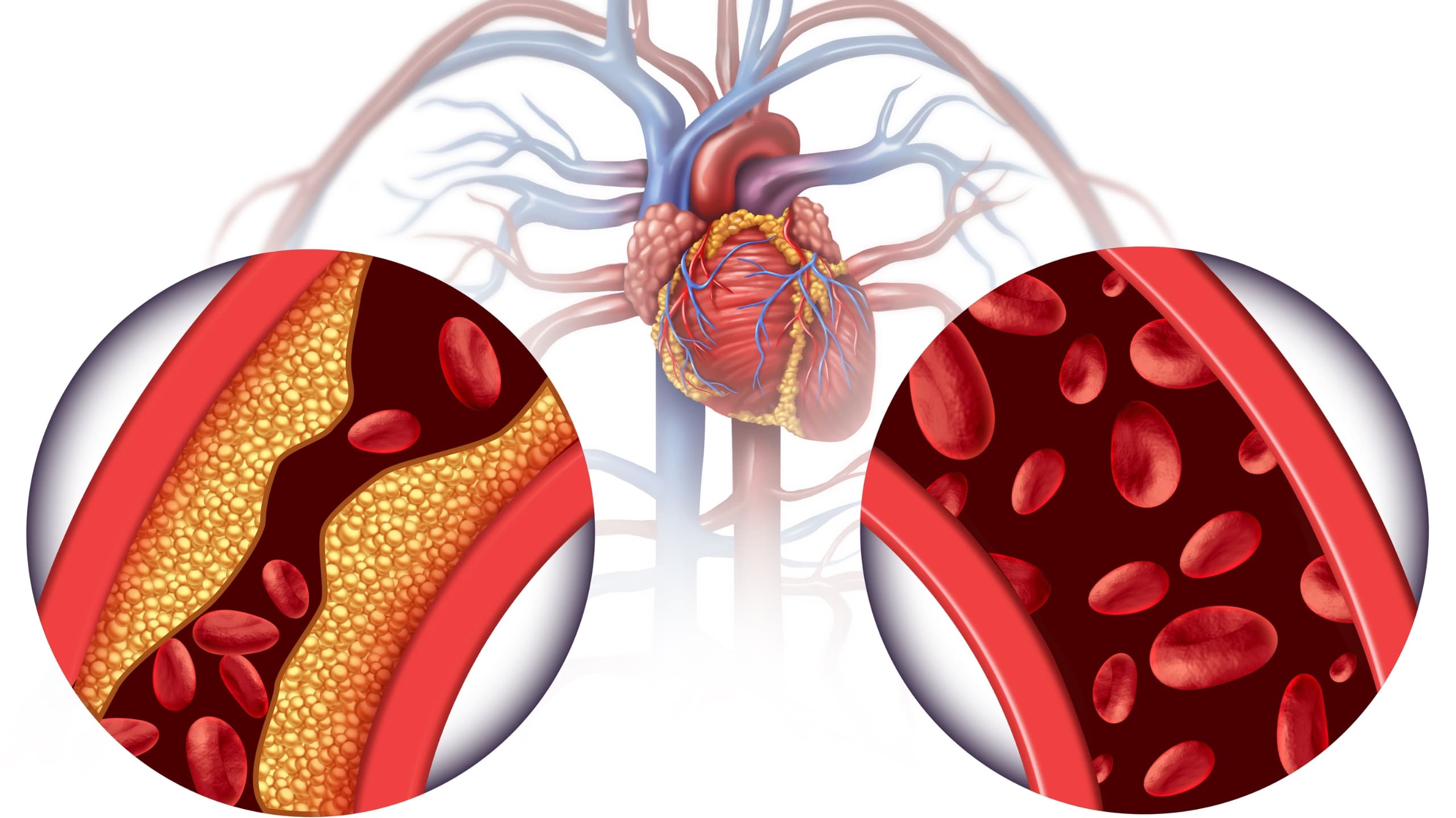 Learn how Chelation therapy can help you remove heavy metals and toxins